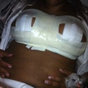 bandaged up