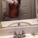 Side view you can see I'm swollen more the puffiness is apparent