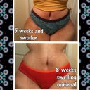 Here I am 8 weeks and loving it!! Look at the difference!!! WOW! My waist use to be before TT 32 inches now it's 29 inches!!! OMG!!! YES!! I hope it gets smaller!!!
