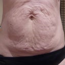 bye bye saggy, dimply skin