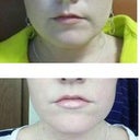 Before and after (1 week)