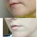 Before and after (1 week)