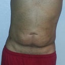 7 days after