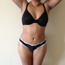 18 days post op