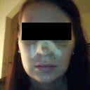 Day 5 - post op