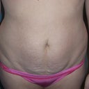 2/6/12 - up close of loose skin