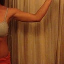 12 days post op left arm