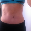 8 weeks PO.  I don't own a bikini...yet.  This is my ole standby tankini pulled up.  Wanted to see how I'd look in a bikini.  Maybe next year....