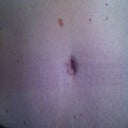 BB is coming along.  Would like to see it take on more of a rounded shape.  It's a little stretched out on the right, probably due to more swelling on the right.  Overall happy with it though.