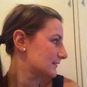 AFTER - 1 day after cast removal - side profile