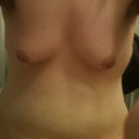 Breasts