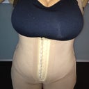 After first massage in new L garment and wearing foam.