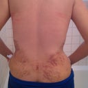 Bruising.... looks like I got ran over by a bus
