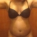 Pre Procedure (front)