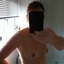 8 MONTHS POST OP