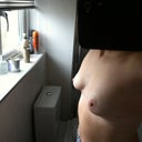 8 MONTHS POST OP