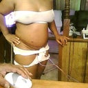 these pic are 3 days after surgery, very swollen