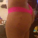 3 Weeks post-op
