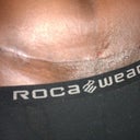 My scar 4 weeks later right now I'm using E-Oil 32,000 IU 100% Natural but when i went in today my PS  is recommending to use Cocoa Butter Formula Skin Therapy Oil so I'm start that too.