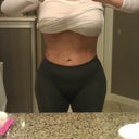 18 DAYS POST OP