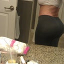 18 DAYS POST OP