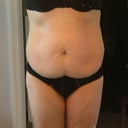PreOp