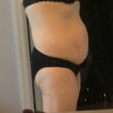 PreOp