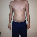 One week before smart lipo. Front Belly.