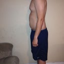 One week before smart lipo. Left side.