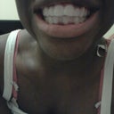 My teeth