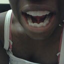 Me teeth