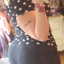 3 months post BBL