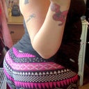 3 months post BBL