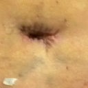 Belly Button - P.O. Day 7