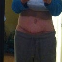 6 1/2 weeks with swelling.