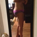 Did doc not remove enough fat? Did I gain? Or extremely swollen?