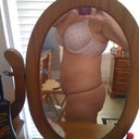 One Week Post Op 7/7/11