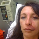 2nd day of treatment at hospital