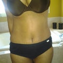 3weeks out. Swelling is starting to go down.