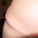 dog-ear, same on both hips