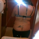 18 days after surgery! do you see a change? I DONT