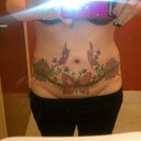 18 days after surgery! do you see a change? I DONT