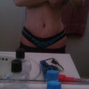 19 days po. Still swelling. Mainly in the lower part