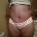 swolllen right above my vagina cant wait for it to go down