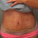 Ignore the horrible spray tan! Two weeks PO Morning