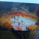 This is me! The blue lines are my ventral hernia!