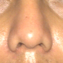 uneven nostril