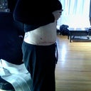 10 days post op