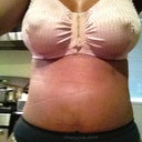8 days post op sooo swollen.. boobies still tough sorta