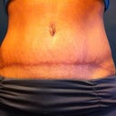 12 weeks po